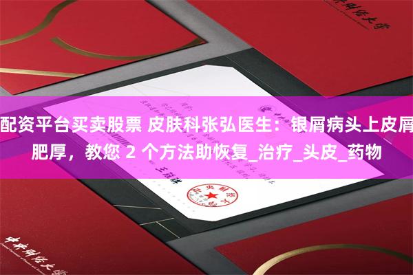 配资平台买卖股票 皮肤科张弘医生：银屑病头上皮屑肥厚，教您 2 个方法助恢复_治疗_头皮_药物